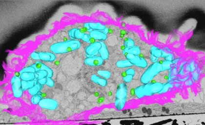 3D electron microscopy of macrophage infected by bacteria (blue) showing lipid droplets (green) and the cell surface (pink).